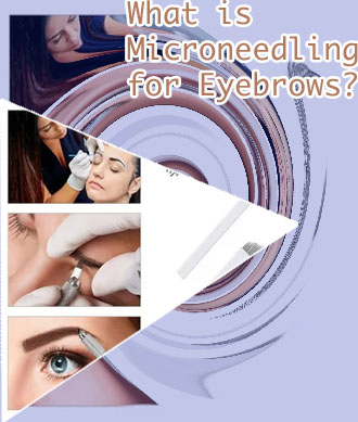 Eyebrow needling