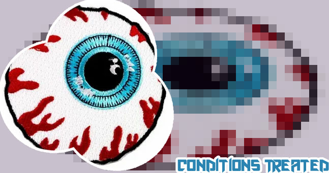 Red patch on eyeball